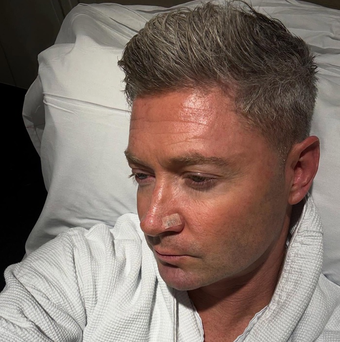 Australian cricketer does skin cancer removal, raises awareness